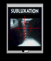 Subluxation